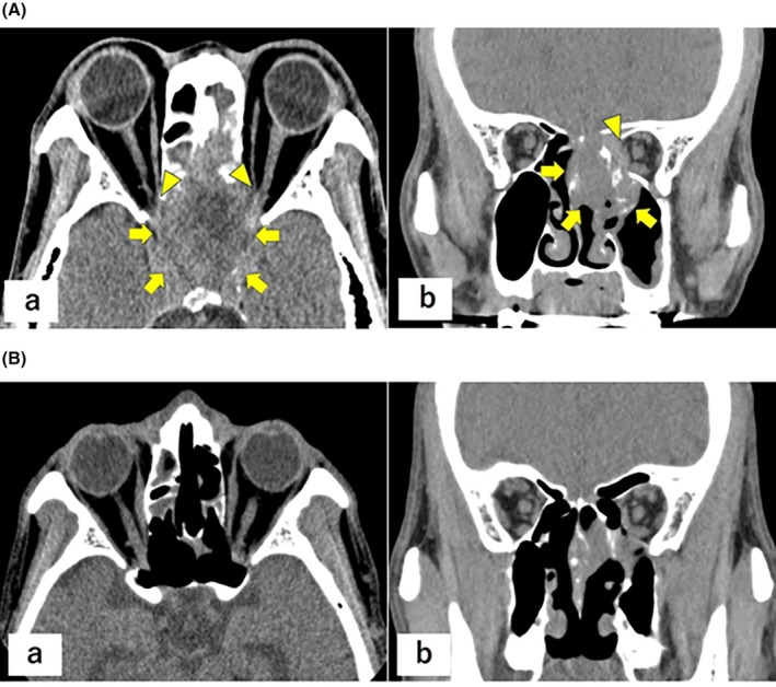 FIGURE 3