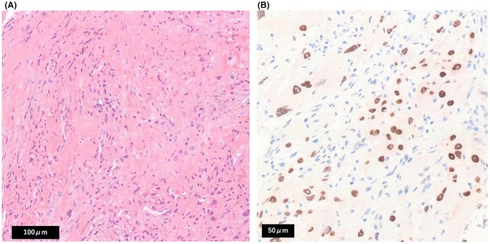 FIGURE 2