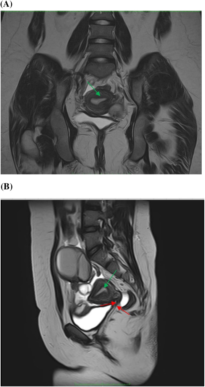 FIGURE 2