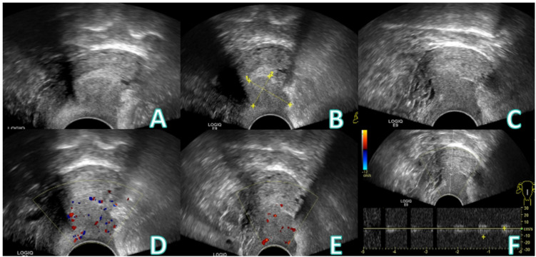 Figure 1