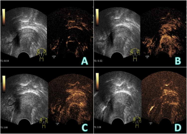 Figure 2