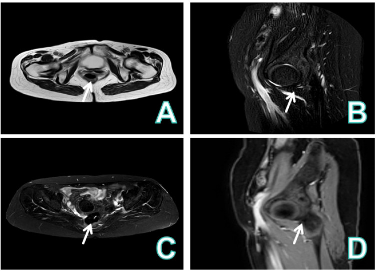 Figure 3