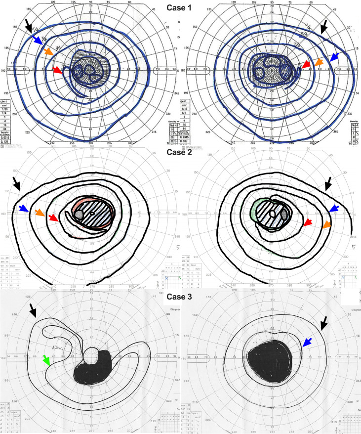 Figure 2