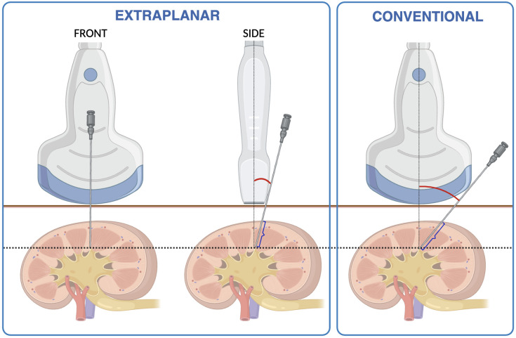 Figure 1