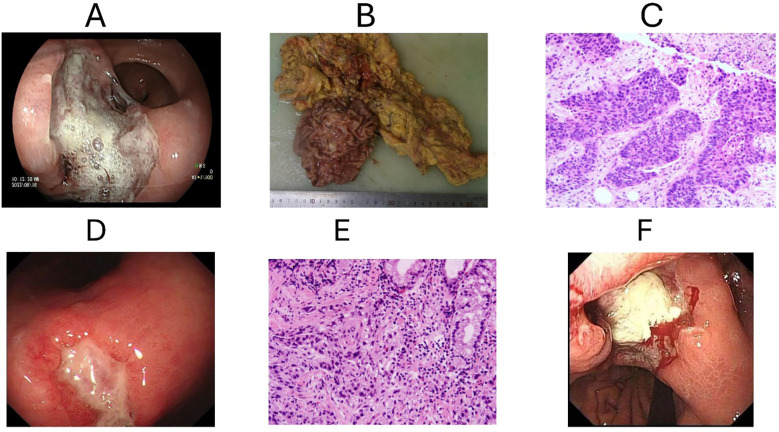 Figure 2