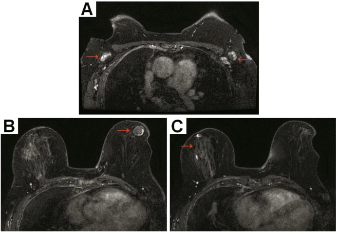 Figure 3