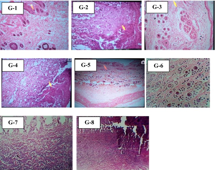 FIGURE 11