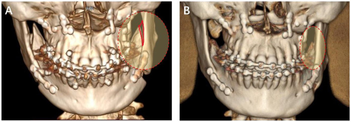 Figure 2