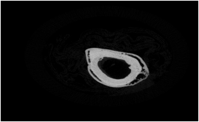 FIGURE 17