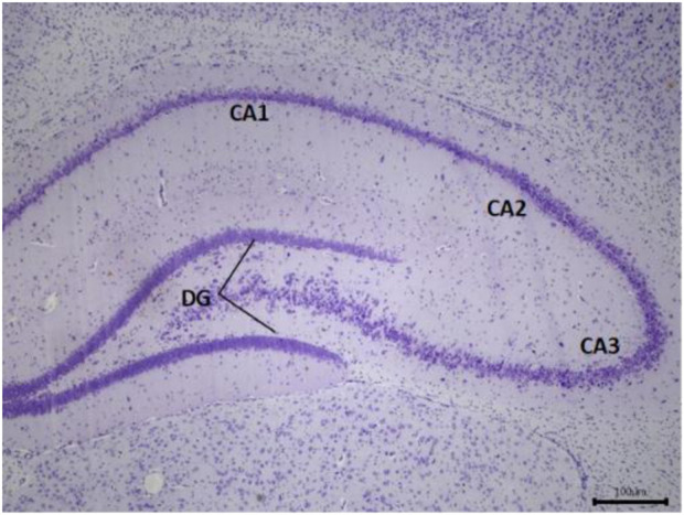 FIGURE 10