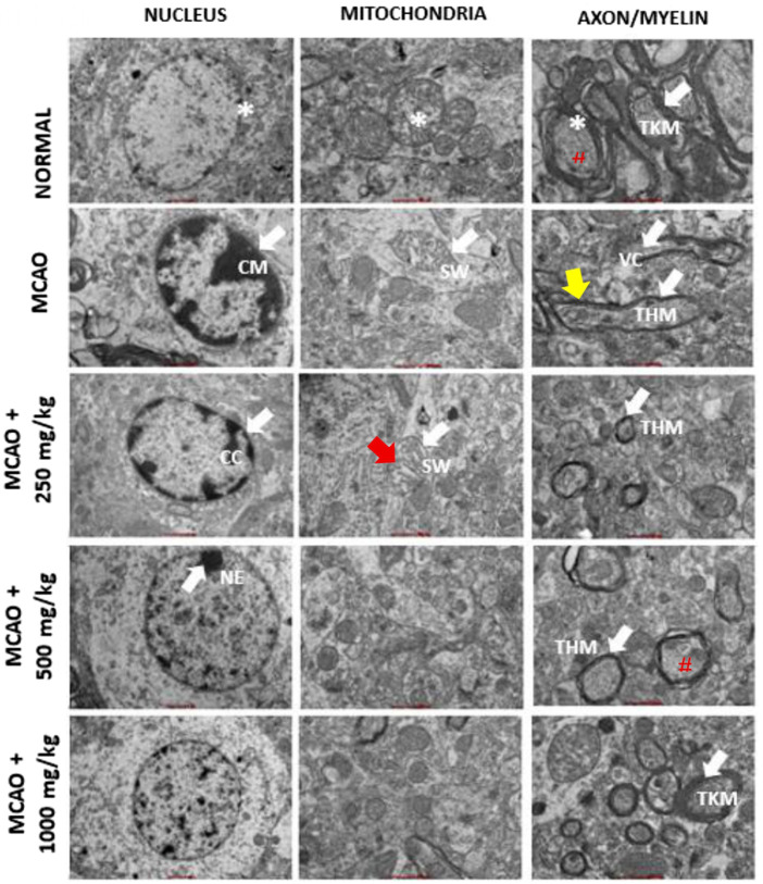 FIGURE 13