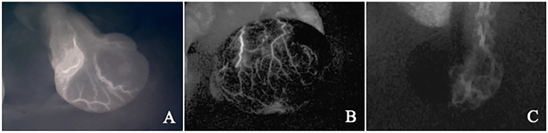 Figure 2