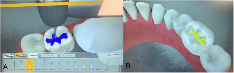 Figure 2