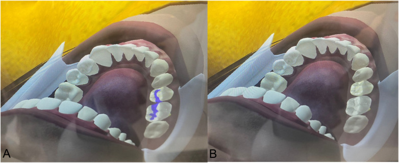 Figure 3