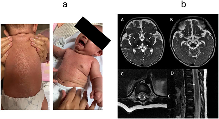Figure 2