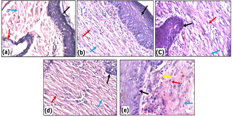 Figure 14