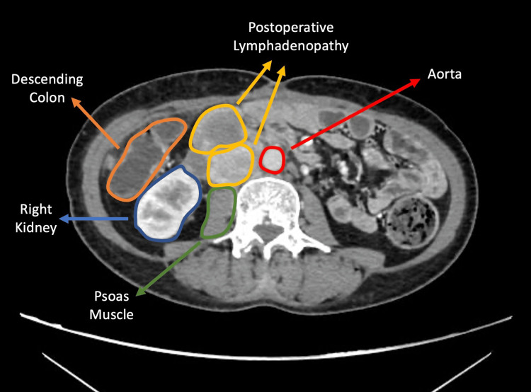 Figure 9
