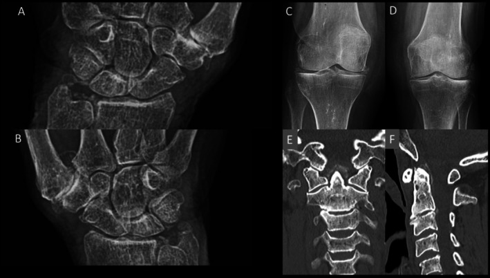 FIGURE 3