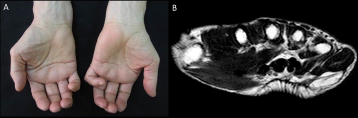 FIGURE 2