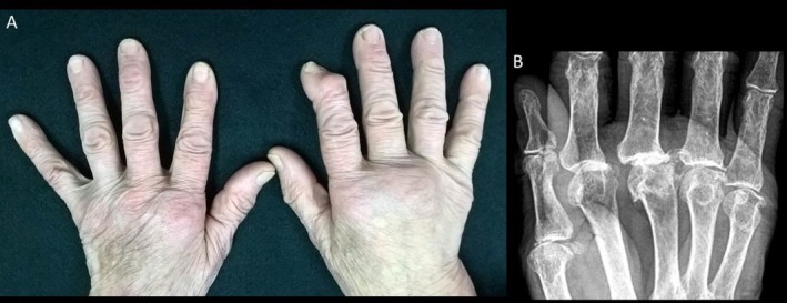 FIGURE 6