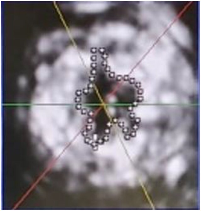 Figure 4