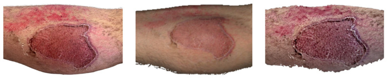 Figure 11