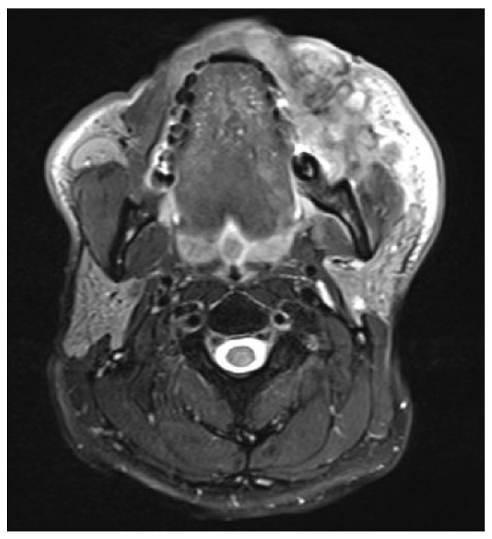 Figure 15