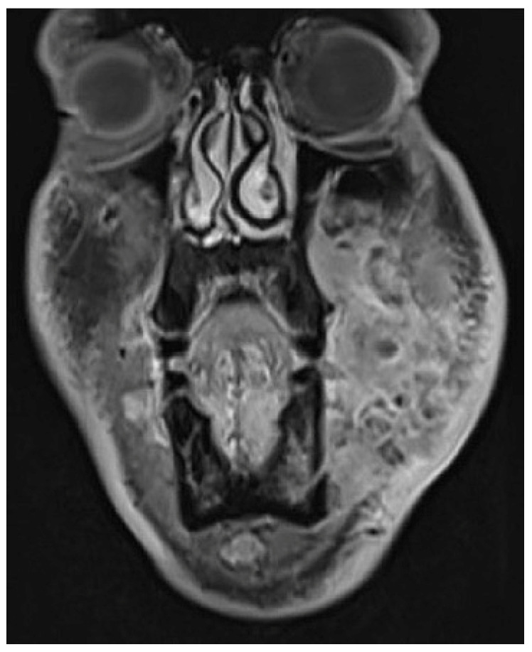 Figure 16