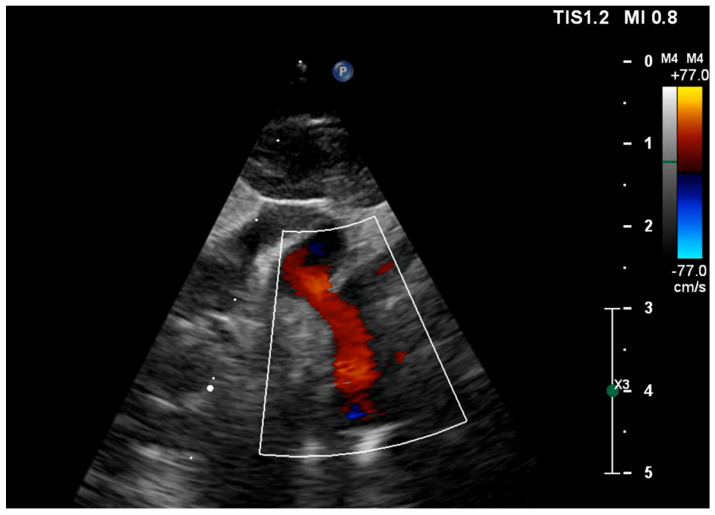 Figure 5