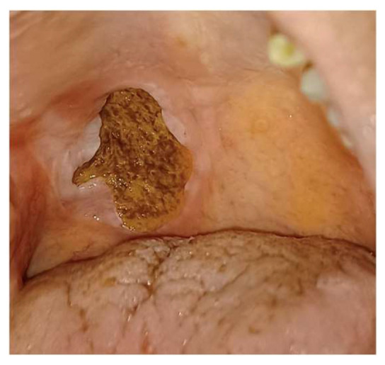 Figure 6