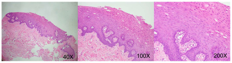 Figure 12