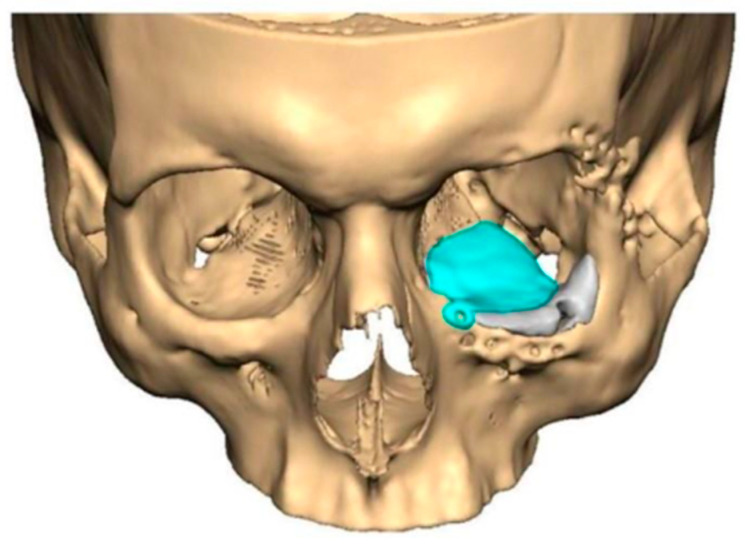 Figure 9