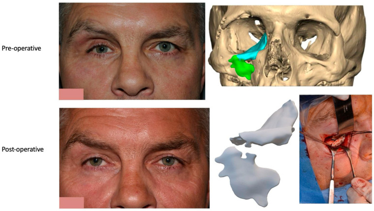 Figure 10
