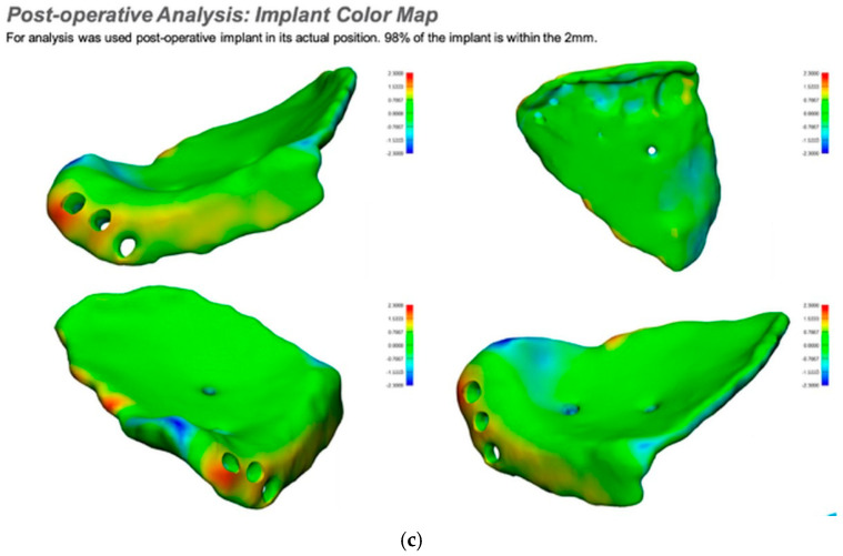 Figure 14