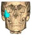 Figure 19