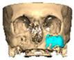 Figure 22