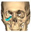 Figure 23