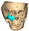 Figure 25