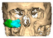 Figure 26
