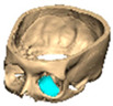 Figure 30