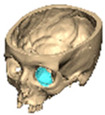 Figure 31