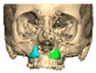 Figure 32