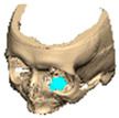 Figure 34
