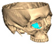 Figure 35
