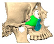 Figure 38