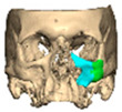 Figure 39