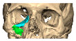 Figure 41