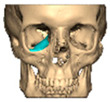 Figure 43