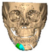 Figure 44