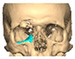 Figure 45